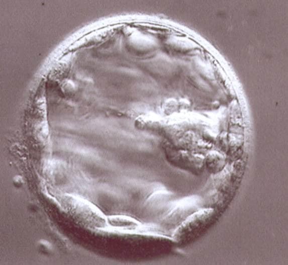 Blastocyst Stage (Day 5-6)