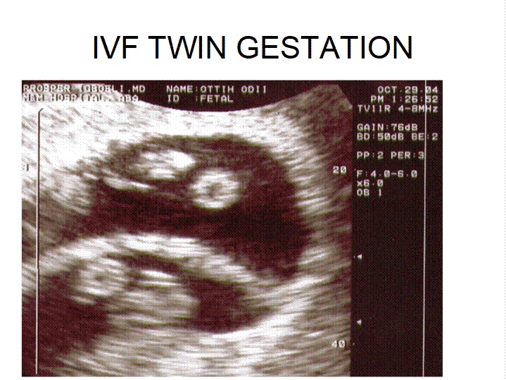 Implantation & Fetal Scan